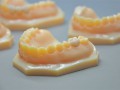 Stratasys 3D 打印機(jī)優(yōu)化義齒制作